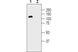 Western blot analysis of human SH-SY5Y neuroblastoma cell lysate:1. (Dipeptidyl-Peptidase 6 (DPP6) Peptide)