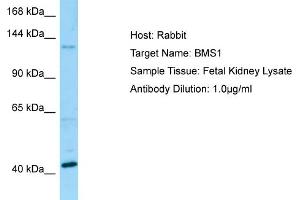 Western Blotting (WB) image for anti-BMS1 Homolog, Ribosome Assembly Protein (BMS1) (C-Term) antibody (ABIN2790143)