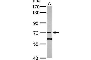 WB Image Sample (50 ug of whole cell lysate) A: Mouse brain 7. (DENND1B 抗体  (Center))