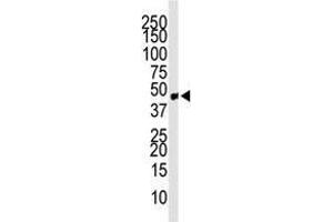 Image no. 1 for anti-Chemokine Binding Protein 2 (CCBP2) (C-Term) antibody (ABIN357386) (CCBP2 抗体  (C-Term))