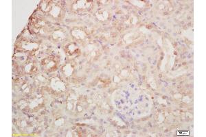 Formalin-fixed and paraffin embedded mouse kidney labeled with Rabbit Anti Arginase II Polyclonal Antibody, Unconjugated (ABIN1387473) at 1:200 followed by conjugation to the secondary antibody and DAB staining (ARG2 抗体  (AA 181-290))