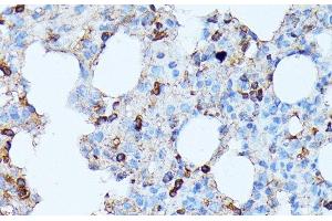 Immunohistochemistry of paraffin-embedded Rat lung using CXCR1 Polyclonal Antibody at dilution of 1:100 (40x lens). (CXCR1 抗体)