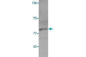 Western blot analysis of K-562 cells with PIAS3 polyclonal antibody  at 1 ug/mL dilution. (PIAS3 抗体  (C-Term))