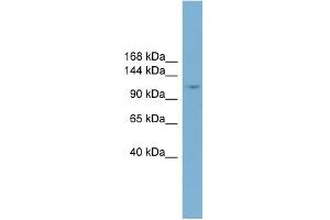 WB Suggested Anti-TRIM37 Antibody Titration:  0. (TRIM37 抗体  (Middle Region))