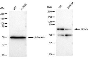 Western blotting analysis using Grp75 antibody (ABIN7798860). (Recombinant HSPA9 抗体)