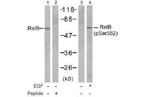 Image no. 1 for anti-V-Rel Reticuloendotheliosis Viral Oncogene Homolog B (RELB) (pSer552) antibody (ABIN197017) (RELB 抗体  (pSer552))