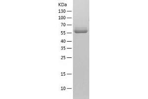 Western Blotting (WB) image for Pyruvate Kinase M2 (PKM2) (AA 1-531) protein (His tag) (ABIN7124723)
