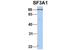 Host:  Rabbit  Target Name:  SF3A1  Sample Type:  Human Adult Placenta  Antibody Dilution:  1. (SF3A1 抗体  (N-Term))