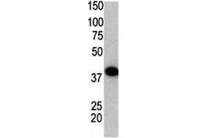 Western blot using SUMO2 antibody and GST-SUMO2 fusion protein. (SUMO2 抗体  (AA 63-93))