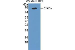 Western Blotting (WB) image for anti-Cytochrome P450, Family 11, Subfamily B, Polypeptide 1 (CYP11B1) (AA 1-498) antibody (ABIN7435544)