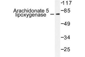 Image no. 1 for anti-Arachidonate 5-Lipoxygenase (ALOX5) antibody (ABIN271992) (ALOX5 抗体)