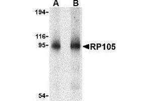 Western blot analysis of RP105 in human spleen tissue lysate with RP105 antibody at (A) 0. (CD180 抗体  (N-Term))
