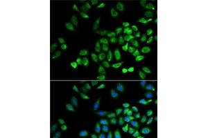 Immunofluorescence analysis of A-549 cells using ANGPTL4 Polyclonal Antibody (ANGPTL4 抗体)