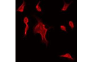 ABIN6275528 staining Hela by IF/ICC. (STK32C 抗体  (Internal Region))