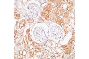 Immunohistochemical staining of human kidney tissue using XIAP polyclonal antibody  at 2 ug/mL . (XIAP 抗体  (C-Term))