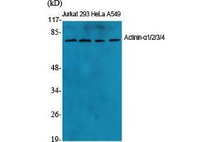 Western Blot (WB) analysis of specific cells using Actinin-alpha1/2/3/4 Polyclonal Antibody. (ACTN1/2/3/4 抗体  (N-Term))