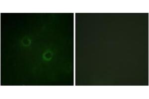 Immunofluorescence analysis of COS7 cells, using Lck (Ab-192) Antibody. (LCK 抗体  (AA 161-210))