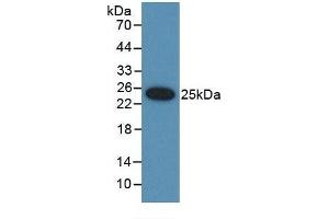 Detection of Recombinant UBD, Rat using Polyclonal Antibody to Ubiquitin D (UBD) (UBD 抗体  (AA 1-155))