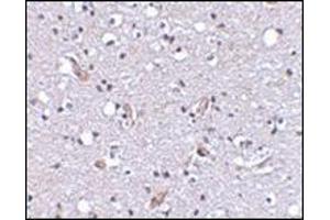 Immunohistochemical staining of human brain tissue using AP30591PU-N at 2. (SLC9A1 抗体  (C-Term, N-Term))