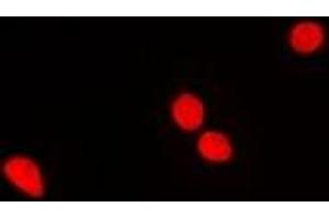 Immunofluorescent analysis of RNGTT staining in MCF7 cells. (RNGTT 抗体)