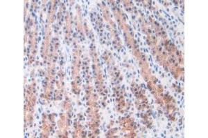 IHC-P analysis of Rat Stomach Tissue, with DAB staining. (ORM1 抗体  (AA 19-186))