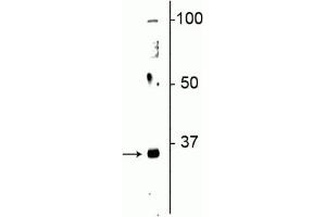 Western blot of neonatal rat brain lysate showing specific immunolabeling of the ~32 kDa Olig2 protein. (OLIG2 抗体)
