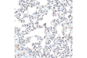 Immunohistochemistry of paraffin-embedded Rat lung using Thioredoxin 1 (Trx1/Thioredoxin 1 (Trx1/TXN)) antibody (ABIN7270798) at dilution of 1:100 (40x lens). (TXN 抗体  (C-Term))