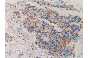 Detection of CD10 in Human Prostate Gland Tissue using Polyclonal Antibody to Neprilysin (CD10) (MME 抗体  (AA 382-538))