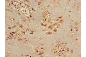 Immunohistochemistry of paraffin-embedded human placenta tissue using ABIN7171778 at dilution of 1:100 (TINF2 抗体  (AA 210-451))