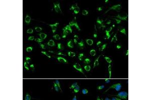 Immunofluorescence analysis of MCF-7 cells using CDKN3 Polyclonal Antibody (CDKN3 抗体)
