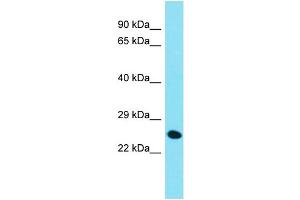 Host: Rabbit  Target Name: Chmp4c  Sample Tissue: Mouse Liver lysates  Antibody Dilution: 1. (CHMP4C 抗体  (C-Term))