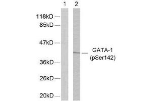 Western blot analysis of extracts from K562 cells using GATA-1 (phospho-Ser142) antibody (E011041). (GATA1 抗体  (pSer142))