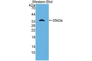 Western blot analysis of the recombinant protein. (Laminin gamma 1 抗体  (AA 1283-1551))