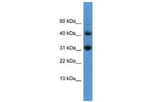 CASP7 antibody used at 0. (Caspase 7 抗体  (N-Term))