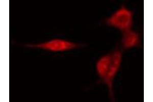 ABIN6274453 staining HeLa cells by IF/ICC. (SMG7 抗体  (Internal Region))