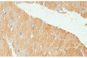 Immunohistochemistry of paraffin-embedded Mouse heart using MYBPC3 Polyclonal Antibody at dilution of 1:100 (40x lens). (MYBPC3 抗体)