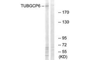 Western blot analysis of extracts from COLO cells, using TUBGCP6 Antibody. (GCP6 抗体  (AA 741-790))