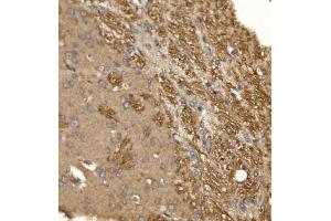 IHC analysis of Paxillin/PXN using anti-Paxillin/PXN antibody (ABIN7602636). (Paxillin 抗体  (AA 9-570))