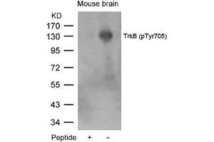 Western blot analysis of extracts from mouse brain tissue using TrkB(Phospho-Tyr705) Antibody and the same antibody preincubated with blocking peptide. (TRKB 抗体  (pTyr705))