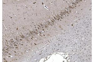 IHC analysis of CISD2 using anti-CISD2 antibody (ABIN7602010).