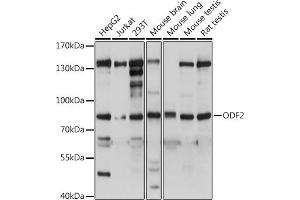 Western blot analysis of extracts of various cell lines, using ODF2 antibody (ABIN7269128) at dilution. (ODF2 抗体  (AA 630-829))