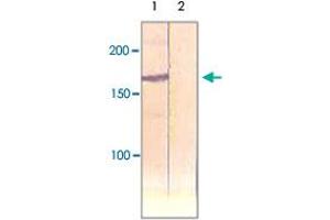 The cell lysate derived from insulin stimulated CHO was immunoprecipitated by IRS1 polyclonal antibody , then immunoprobed by the same antibody at 1 : 500 (Lane 1). (IRS1 抗体)