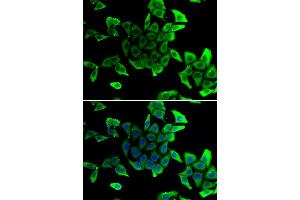 Immunofluorescence analysis of U2OS cells using SGCD antibody (ABIN6292039). (SGCD 抗体)