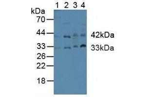 Western blot analysis of (1) Human Placenta Tissue, (2) Human HeLa cells, (3) Rat Heart Tissue and (4) Rat Uterus Tissue. (Caspase 9 抗体  (AA 331-416))