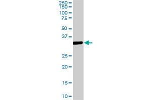 MEOX2 monoclonal antibody (M08), clone 5E1. (MEOX2 抗体  (AA 1-303))