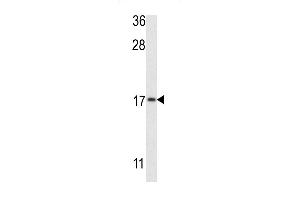 Western blot analysis of G8b (M1LC3B) Antibody (T93/Y99) 1802e in MCF-7 cell line lysates (35 μg/lane). (APG8b (AA 74-106) 抗体)