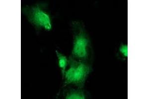 Anti-BEST3 mouse monoclonal antibody (ABIN2453917) immunofluorescent staining of COS7 cells transiently transfected by pCMV6-ENTRY BEST3 (RC218436). (Bestrophin 3 抗体)