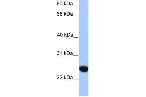WB Suggested Anti-CSGlcA-T Antibody Titration:  0. (CHPF2 抗体  (N-Term))
