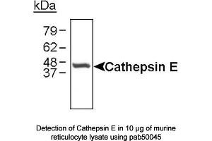 Image no. 1 for anti-Cathepsin E (CTSE) (C-Term) antibody (ABIN363354) (Cathepsin E 抗体  (C-Term))