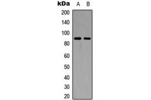 Western blot analysis of FGFR4 expression in HEK293T (A), PC12 (B) whole cell lysates. (FGFR4 抗体  (C-Term))